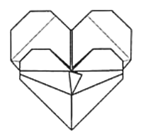 Pregnant heart